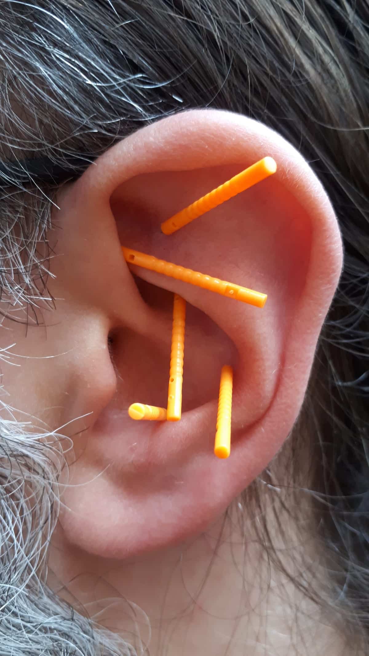 Ear acupuncture image